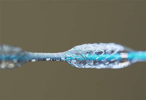  Nitinol: Ein Wundermaterial für die Zukunft der Medizintechnik!